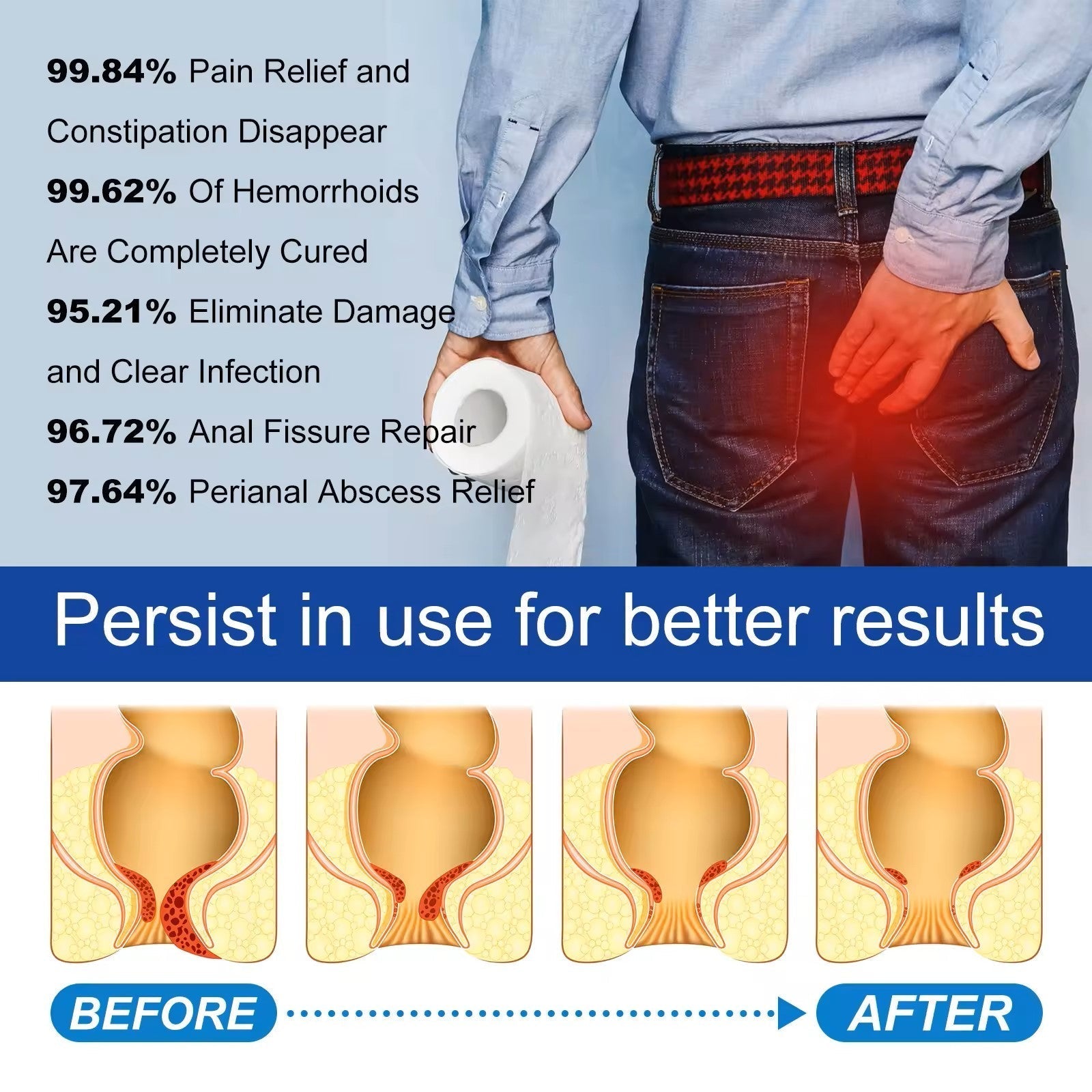 Hemorrhoids Capsules