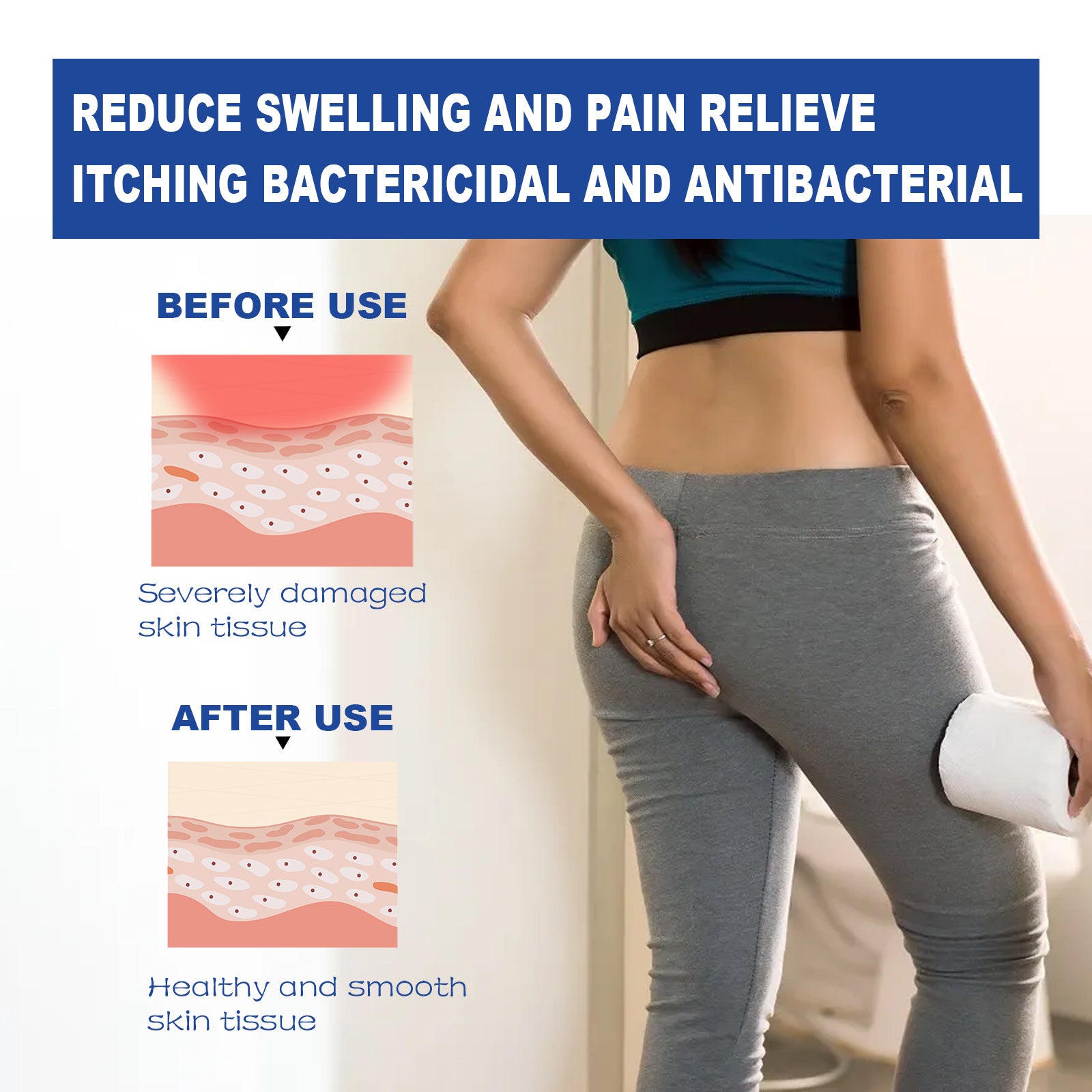 Hemorrhoid Cream
