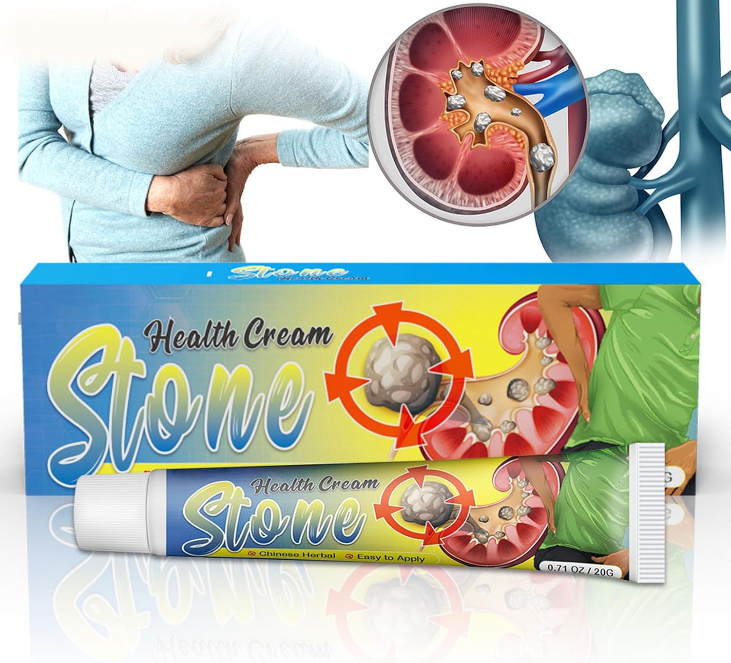 Cleansing Cream for Kidney Stones